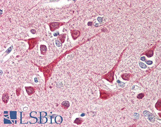 Anti-CIDEB antibody IHC of human brain, cortex. Immunohistochemistry of formalin-fixed, paraffin-embedded tissue after heat-induced antigen retrieval. Antibody LS-B482 concentration 5 ug/ml.