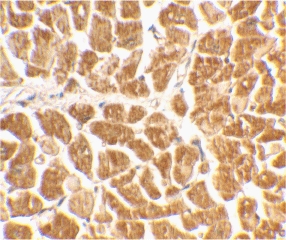 IHC of human heart tissue using CX3CR1 antibody at 2 ug/ml.