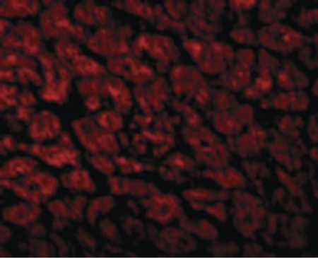 Immunofluorescence of CX3CR1 in Human Heart cells with CX3CR1 antibody at 10 ug/ml.