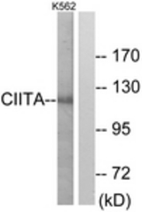 Western blot of extracts from K562 cells, using CIITA Antibody. The lane on the right is treated with the synthesized peptide.