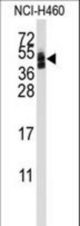 Western blot of anti-CXADR Antibody in NCI-H460 cell line lysates (35 ug/lane). CXADR(arrow) was detected using the purified antibody.