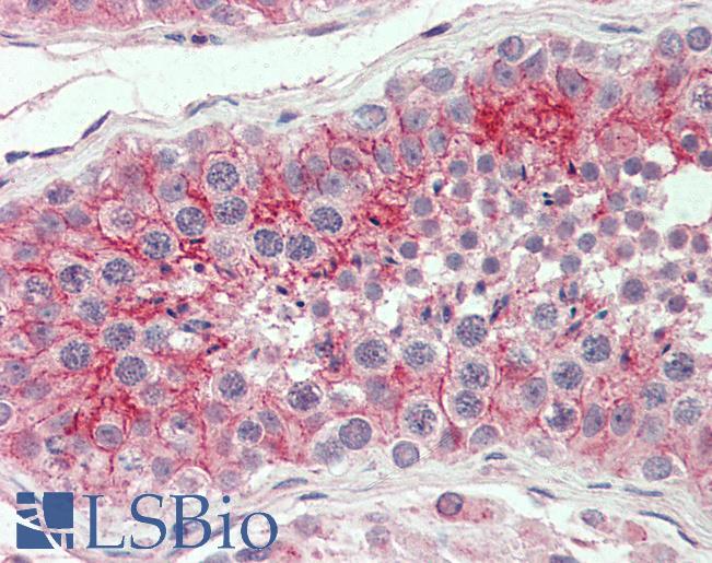 Anti-CXADR antibody LS-A8845 IHC of human testis. Immunohistochemistry of formalin-fixed, paraffin-embedded tissue after heat-induced antigen retrieval.