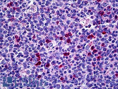 Anti-CIITA antibody IHC of human tonsil. Immunohistochemistry of formalin-fixed, paraffin-embedded tissue after heat-induced antigen retrieval. Antibody LS-B5490 concentration 5 ug/ml.