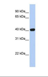 Fetal brain lysate. Antibody concentration: 1.0 ug/ml. Gel concentration: 12%.