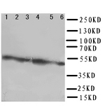 WB of CXADR antibody. Lane 1: Rat Pancreas Tissue Lysate. Lane 2: Rat Brain Tissue Lysate. Lane 3: Rat Heart Tissue Lysate. Lane 4: HELA Cell Lysate. Lane 5: 293T Cell Lysate. Lane 6: COLO320 Cell Lysate.