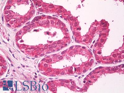 Anti-CXADR antibody IHC of human prostate. Immunohistochemistry of formalin-fixed, paraffin-embedded tissue after heat-induced antigen retrieval. Antibody LS-B8019 dilution 5 ug/ml.