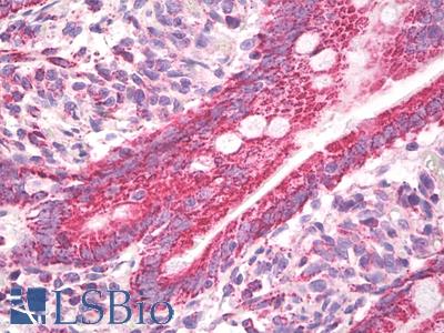 Anti-CXADR antibody IHC staining of human small intestine. Immunohistochemistry of formalin-fixed, paraffin-embedded tissue after heat-induced antigen retrieval.