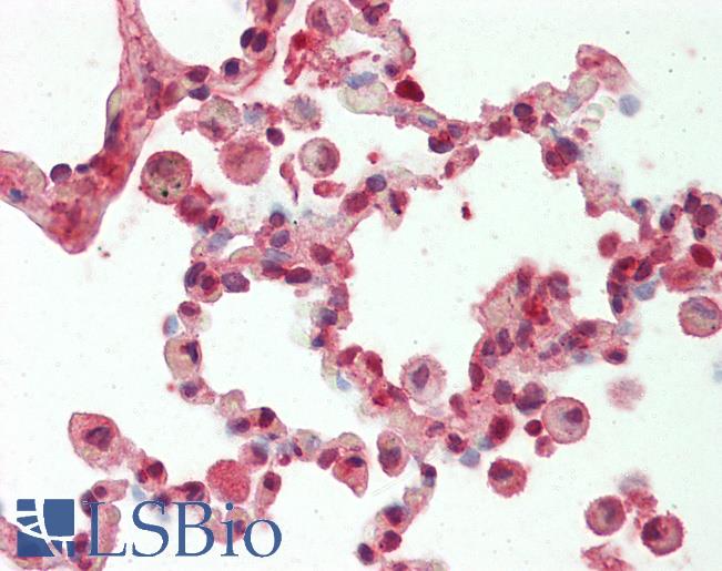 Human Lung: Formalin-Fixed, Paraffin-Embedded (FFPE)