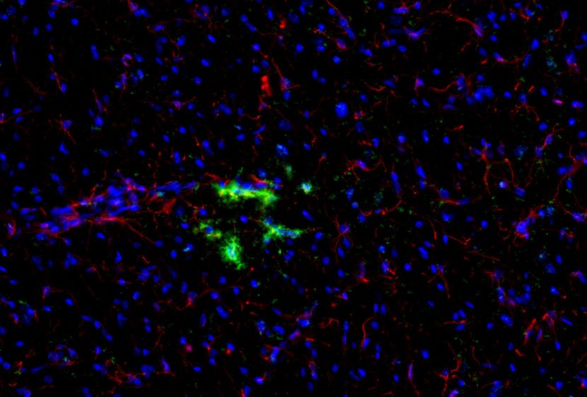 IHC of IP-10 / CXCL10 antibody LS-C104828