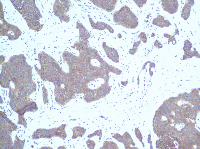 IHC of IP-10 / CXCL10 antibody LS-C104367