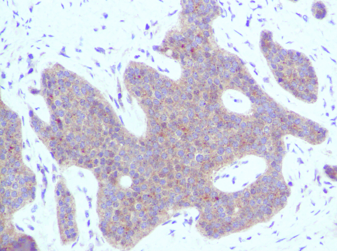 IHC of IP-10 / CXCL10 antibody LS-C104367