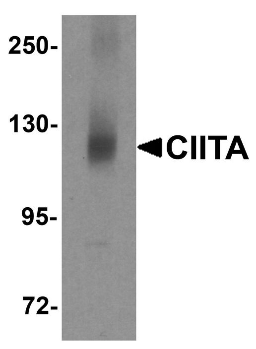 Western blot analysis of CIITA in mouse brain tissue lysate with CIITA antibody at 1 ug/ml.