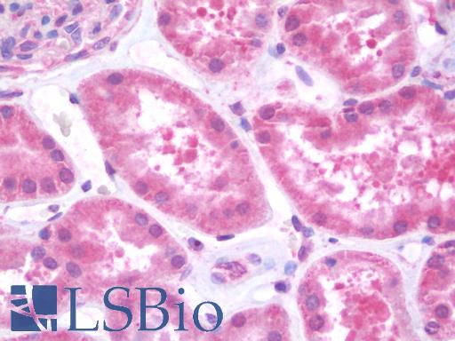 Anti-CXCL11 antibody IHC staining of human kidney. Immunohistochemistry of formalin-fixed, paraffin-embedded tissue after heat-induced antigen retrieval. Antibody LS-B9948 concentration 10 ug/ml.