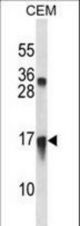 CXCL11 Antibody western blot of CEM cell line lysates (35 ug/lane). The CXCL11 antibody detected the CXCL11 protein (arrow).