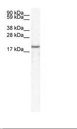 Fetal Skeletal Muscle Lysate