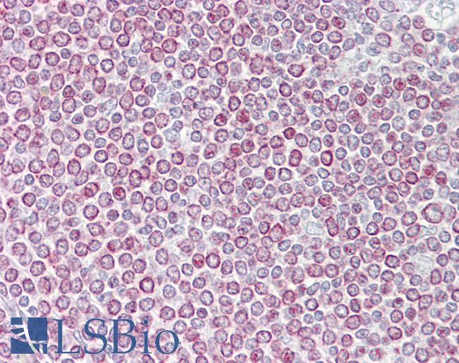 Anti-CXCL14 antibody IHC of human spleen. Immunohistochemistry of formalin-fixed, paraffin-embedded tissue after heat-induced antigen retrieval. Antibody LS-B6967 concentration 5 ug/ml.