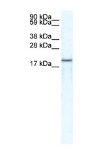 CXCL14 antibody LS-B6967 Western blot of skeletal muscle lysate. Antibody concentration 5 ug/ml.