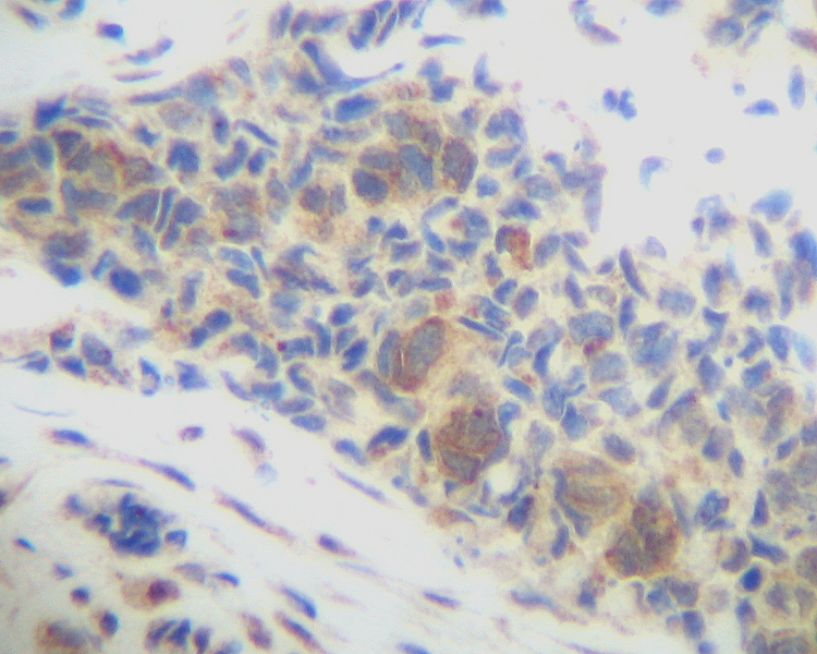 IHC of CXCL14 antibody LS-C104496