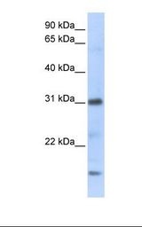 Transfected 293T cell lysate. Antibody concentration: 1.0 ug/ml. Gel concentration: 12%.