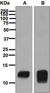 Western blot analysis on (A) human spleen and (B) human platelet lysates using anti-PF4 antibody.