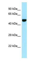 CILP antibody Western Blot of 721_B.