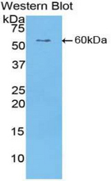 Western blot of recombinant CILP.