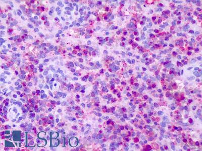 Anti-CXCR1 antibody IHC of human spleen, neutrophils. Immunohistochemistry of formalin-fixed, paraffin-embedded tissue after heat-induced antigen retrieval. Antibody LS-A808 dilution 16 ug/ml.