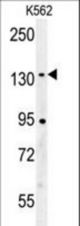 CILP2 Antibody western blot of K562 cell line lysates (35 ug/lane). The CILP2 antibody detected the CILP2 protein (arrow).