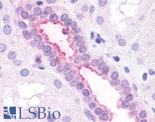 Anti-CXCR2 antibody LS-A802 IHC of human kidney. Immunohistochemistry of formalin-fixed, paraffin-embedded tissue after heat-induced antigen retrieval.