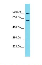 Western blot of Human 721_B. CIRH1A antibody dilution 1.0 ug/ml.