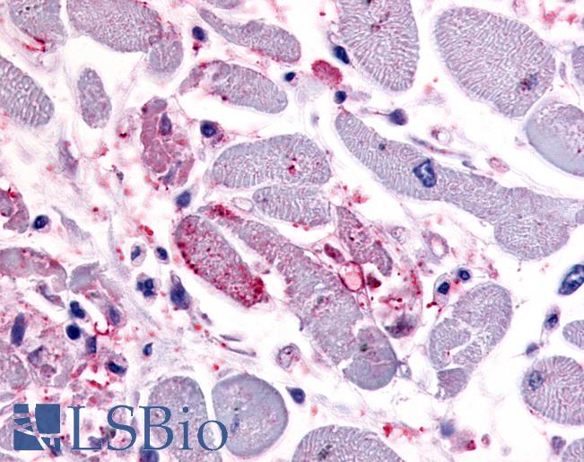 Anti-CXCR4 antibody LS-A1381 IHC of human heart. Immunohistochemistry of formalin-fixed, paraffin-embedded tissue after heat-induced antigen retrieval.