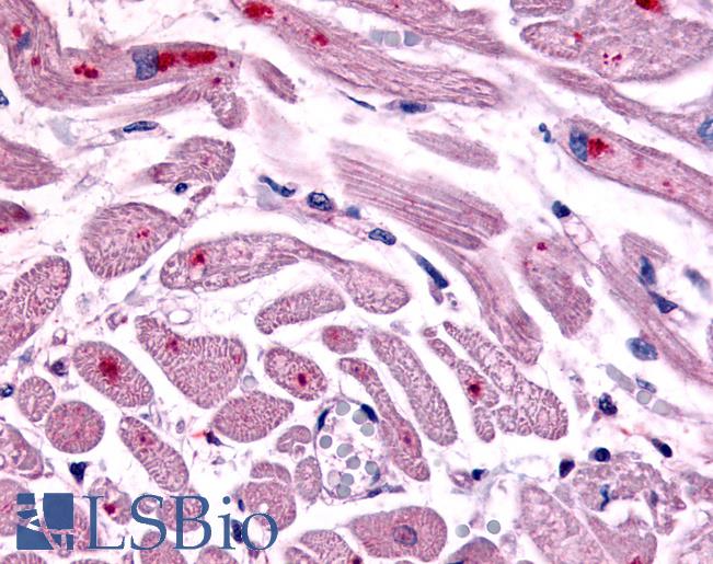 Anti-CXCR4 antibody LS-A1377 IHC of human heart. Immunohistochemistry of formalin-fixed, paraffin-embedded tissue after heat-induced antigen retrieval.