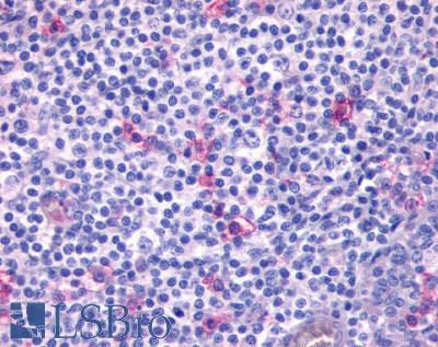 Anti-CXCR4 antibody LS-A1376 IHC of human tonsil. Immunohistochemistry of formalin-fixed, paraffin-embedded tissue after heat-induced antigen retrieval.