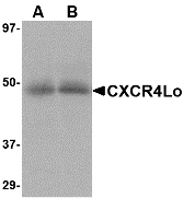 Western blot of CXCR4 in (A) human spleen and (B) human thymus tissue lysate with CXCR4-Lo antibody at 10 ug/ml.