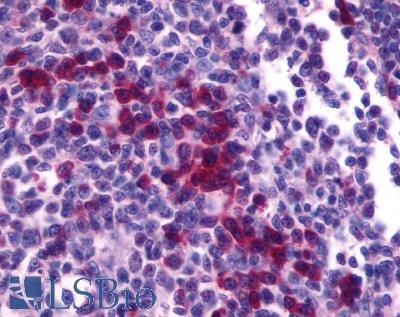 Anti-CXCR4 antibody LS-A1380 IHC of human tonsil. Immunohistochemistry of formalin-fixed, paraffin-embedded tissue after heat-induced antigen retrieval.