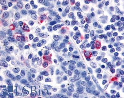 Anti-CXCR6 antibody LS-A1102 IHC of human tonsil, interfollicular zone. Immunohistochemistry of formalin-fixed, paraffin-embedded tissue after heat-induced antigen retrieval.