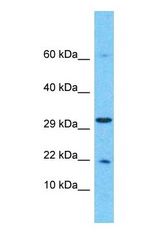 Western blot of CIRBP Antibody with human HeLa Whole Cell lysate.
