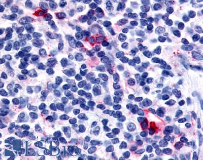 Anti-CXCR6 antibody LS-A1104 IHC of human tonsil, interfollicular zone. Immunohistochemistry of formalin-fixed, paraffin-embedded tissue after heat-induced antigen retrieval.
