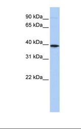 Placenta lysate. Antibody concentration: 1.0 ug/ml. Gel concentration: 12%.