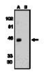 Western blot of anti-Bonzo (NT2) antibody at 1 ug/ml on human spleen tissue lysates.