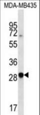 CXCR6 Antibody western blot of MDA-MB435 cell line lysates (35 ug/lane). The CXCR6 antibody detected the CXCR6 protein (arrow).