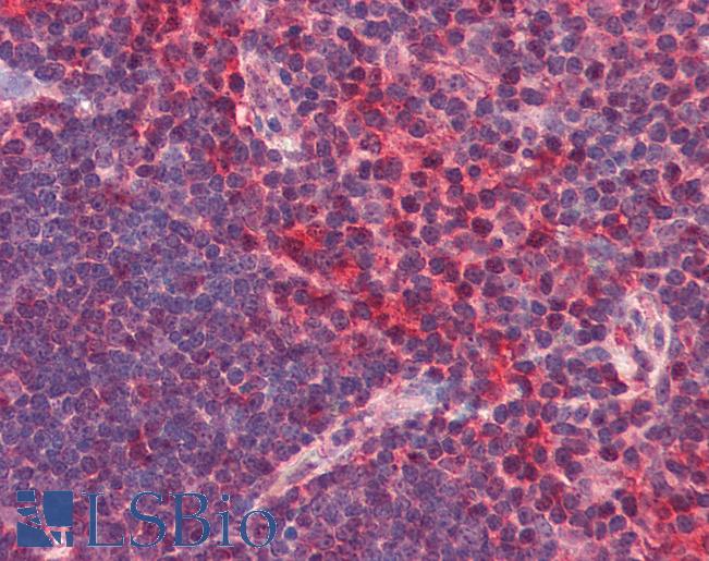 Anti-CXCR6 antibody IHC of human thymus. Immunohistochemistry of formalin-fixed, paraffin-embedded tissue after heat-induced antigen retrieval. Antibody LS-B2518 concentration 5 ug/ml.