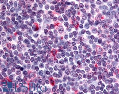 Anti-CXCR6 antibody LS-A1105 IHC of human tonsil, immunoblasts. Immunohistochemistry of formalin-fixed, paraffin-embedded tissue after heat-induced antigen retrieval.