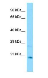 CXXC4 antibody Western Blot of MCF7.