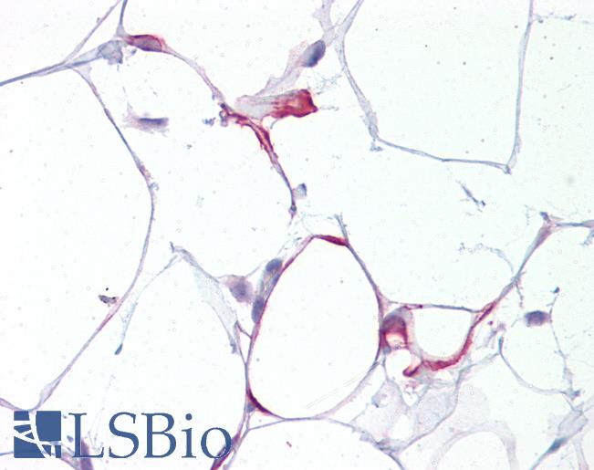 Anti-CXXC4 antibody IHC of human adipocytes. Immunohistochemistry of formalin-fixed, paraffin-embedded tissue after heat-induced antigen retrieval. Antibody LS-B6986 concentration 5 ug/ml.
