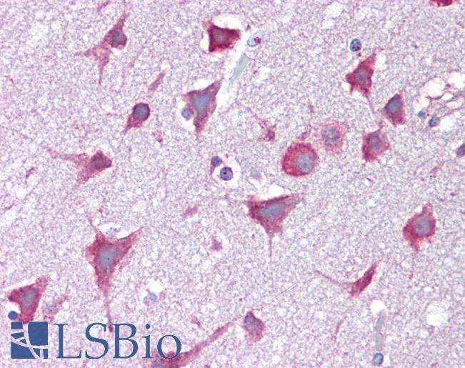 Anti-CXXC4 antibody IHC of human brain, cortex. Immunohistochemistry of formalin-fixed, paraffin-embedded tissue after heat-induced antigen retrieval. Antibody LS-B6986 concentration 5 ug/ml.