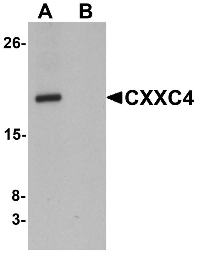 Western blot analysis of CXXC4 in human brain tissue lysate with CXXC4 antibody at 1 ug/ml in (A) the absence and (B) the presence of blocking peptide.