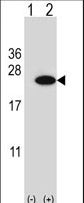 Western blot of CIRBP (arrow) using rabbit polyclonal CIRBP Antibody. 293 cell lysates (2 ug/lane) either nontransfected (Lane 1) or transiently transfected (Lane 2) with the CIRBP gene.