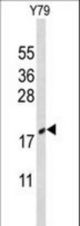Western blot of CIRBP Antibody in Y79 cell line lysates (35 ug/lane). CIRBP (arrow) was detected using the purified antibody.