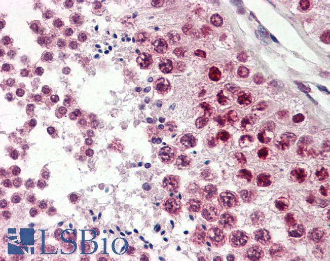Anti-CIRP / CIRBP antibody IHC of human testis. Immunohistochemistry of formalin-fixed, paraffin-embedded tissue after heat-induced antigen retrieval. Antibody LS-B8341 dilution 3.75 ug/ml.